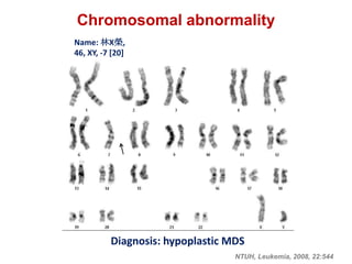Name: 林X榮,
46, XY, -7 [20]
Chromosomal abnormality
Diagnosis: hypoplastic MDS
NTUH, Leukemia, 2008, 22:544
 