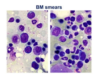 BM smears
 
