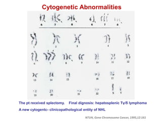 Cytogenetic Abnormalities
NTUH, Gene Chromosome Cancer, 1995,12:161
The pt received splectomy. Final dignosis: hepatosplenic Tγ/δ lymphoma
A new cytogentc- clinicopathological entity of NHL
 