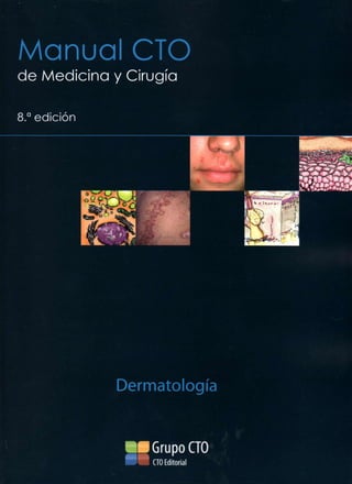 Manual CTO
de Medicina y Cirugía

8.   a
         edición




                   Dermatología



                       Grupo CTO
                       CTO Editorial
 