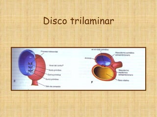 Disco trilaminar 