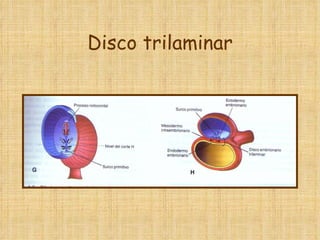 Disco trilaminar 
