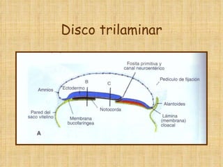 Disco trilaminar 