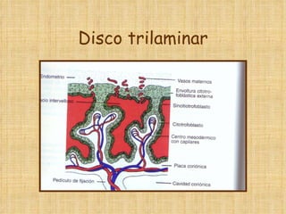 Disco trilaminar 