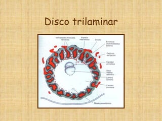 Disco trilaminar 