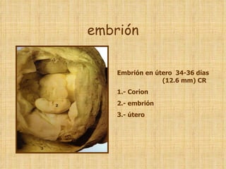 embrión Embrión en útero  34-36 días  (12.6 mm) CR 1.- Corion 2.- embrión 3.- útero 
