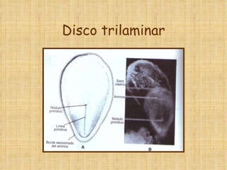 Disco trilaminar 