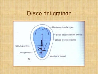 Disco trilaminar 