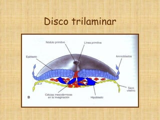 Disco trilaminar 