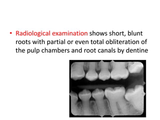 03 DISORDERS OF DEVELOPMENT OF TEETH AND CRANIOFACIAL ANOMALIES.pptx