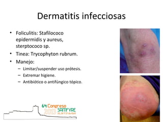 Dermatitis infecciosas
• Foliculitis: Stafilococo
epidermidis y aureus,
sterptococo sp.
• Tinea: Trycophyton rubrum.
• Man...