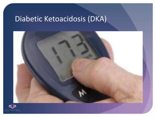 Diabetic Ketoacidosis (DKA)
 