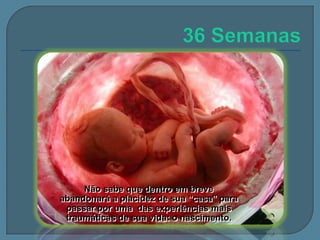Não sabe que dentro em breve
abandonará a placidez de sua “casa” para
passar por uma das experiências mais
traumáticas de sua vida: o nascimento.

 