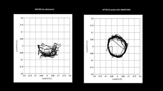 BEFORE (at admission) AFTER (6 weeks with INMOTION)
 