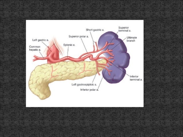 esplenectomia laparoscópica