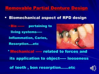 * Mechanical ----- related to forces and
its application to object----- looseness
of teeth , bon resorption……etc
Removable Partial Denture Design
• Biomechanical aspect of RPD design
• Bio ------ pertaining to
living systems-----
Inflammation, Caries,
Resorption….etc
 