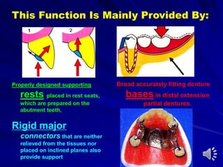 This Function Is Mainly Provided By:
Properly designed supporting
rests placed in rest seats,
which are prepared on the
abutment teeth,
Broad accurately fitting denture
bases in distal extension
partial dentures.
Rigid major
connectors that are neither
relieved from the tissues nor
placed on inclined planes also
provide support
 