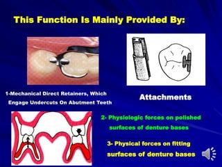 This Function Is Mainly Provided By:
1-Mechanical Direct Retainers, Which
Engage Undercuts On Abutment Teeth
Attachments
2- Physiologic forces on polished
surfaces of denture bases
3- Physical forces on fitting
surfaces of denture bases
 