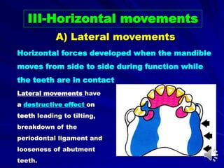 III-Horizontal movements
Horizontal forces developed when the mandible
moves from side to side during function while
the teeth are in contact
Lateral movements have
a destructive effect on
teeth leading to tilting,
breakdown of the
periodontal ligament and
looseness of abutment
teeth.
A) Lateral movements
 