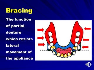 Bracing
The function
of partial
denture
which resists
lateral
movement of
the appliance
 