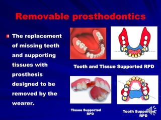 Tissue Supported
RPD
Tooth and Tissue Supported RPD
Tooth Supported
RPD
The replacement
of missing teeth
and supporting
tissues with
prosthesis
designed to be
removed by the
wearer.
Removable prosthodontics
 