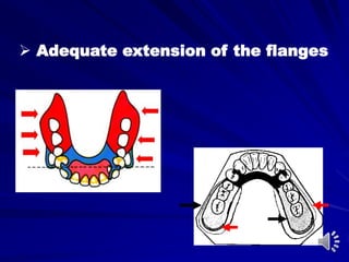  Adequate extension of the flanges
 