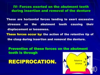 These are horizontal forces tending to exert excessive
stresses on the abutment teeth causing their
displacement or looseness.
These forces occur by: the action of the retentive tip of
the clasp during insertion and removal the denture.
Prevention of these forces on the abutment
tooth is through
RECIPROCATION.
IV- Forces exerted on the abutment teeth
during insertion and removal of the denture
 