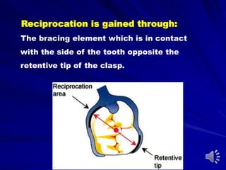 Reciprocation is gained through:
The bracing element which is in contact
with the side of the tooth opposite the
retentive tip of the clasp.
 