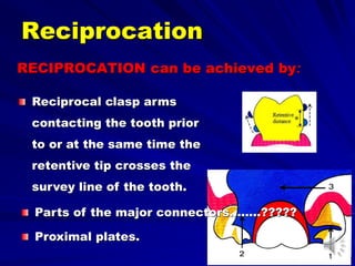 RECIPROCATION can be achieved by:
Reciprocal clasp arms
contacting the tooth prior
to or at the same time the
retentive tip crosses the
survey line of the tooth.
Reciprocation
Parts of the major connectors……..?????
Proximal plates.
 