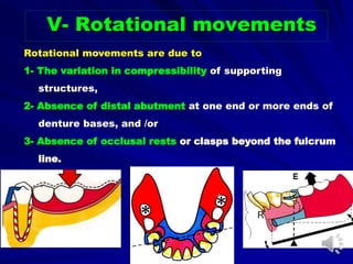 V- Rotational movements
Rotational movements are due to
1- The variation in compressibility of supporting
structures,
2- Absence of distal abutment at one end or more ends of
denture bases, and /or
3- Absence of occlusal rests or clasps beyond the fulcrum
line.
 