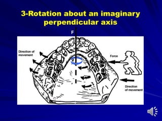 F
3-Rotation about an imaginary
perpendicular axis
 