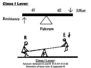 Class I Lever:
fulcrum: between E and R R X d1= E X d2
Direction of lever arm: E opposite R
Class I Lever:
 