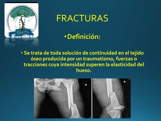 FRACTURAS
•Definición:
• Se trata de toda solución de continuidad en el tejido
óseo producida por un traumatismo, fuerzas o
tracciones cuya intensidad superen la elasticidad del
hueso.
 