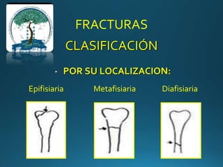 FRACTURAS
CLASIFICACIÓN
• POR SU LOCALIZACION:
Epifisiaria Metafisiaria Diafisiaria
 
