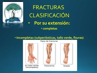 FRACTURAS
• completas
• Incompletas (subperiósticas, tallo verde, fisuras)
• Por su extensión:
CLASIFICACIÓN
 