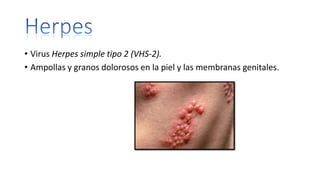• Virus Herpes simple tipo 2 (VHS-2).
• Ampollas y granos dolorosos en la piel y las membranas genitales.
 