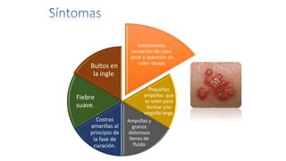 Inicialmente,
sensación de calor,
picor y aparición de
color rosado
Pequeñas
ampollas que
se unen para
formar una
ampolla larga.
Ampollas y
granos
dolorosos
llenos de
fluido
Costras
amarillas al
principio de
la fase de
curación.
Fiebre
suave.
Bultos en
la ingle.
 