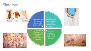 Se pueden ver
los huevos
(liendres) o
piojos adultos
Picazón en un
área cubierta de
vello púbico (a
menudo
empeora en la
noche)
Reacción
cutánea de
color azul
grisáceo
Úlceras
(lesiones) en
el área genital
debido a
picaduras y al
rascado
Cabeza pubis liendres
 