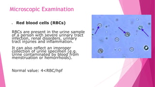  Red blood cells (RBCs)
RBCs are present in the urine sample
of a person with severe urinary tract
infection, renal disorders, urinary
tract injuries and inflammation.
It can also reflect an improper
collection of urine specimen (e.g.
Urine contaminated by blood from
menstruation or hemorrhoids).
Normal value: 4<RBC/hpf
Microscopic Examination
 