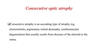 Consecutive optic atrophy
Consecutive atrophy is an ascending type of atrophy (eg,
chorioretinitis, pigmentary retinal dystrophy, cerebromacular
degeneration) that usually results from diseases of the choroid or the
retina.
 