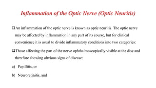 Inflammation of the Optic Nerve (Optic Neuritis)
An inflammation of the optic nerve is known as optic neuritis. The optic nerve
may be affected by inflammation in any part of its course, but for clinical
convenience it is usual to divide inflammatory conditions into two categories:
Those affecting the part of the nerve ophthalmoscopically visible at the disc and
therefore showing obvious signs of disease:
a) Papillitis, or
b) Neuroretinitis, and
 
