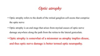 Optic atrophy
• Optic atrophy refers to the death of the retinal ganglion cell axons that comprise
the optic nerve
• Optic atrophy is an end stage that arises from myriad causes of optic nerve
damage anywhere along the path from the retina to the lateral geniculate.
• Optic atrophy is somewhat of a misnomer as atrophy implies disuse,
and thus optic nerve damage is better termed optic neuropathy.
 
