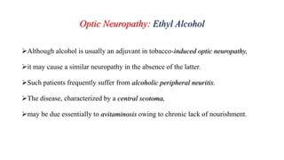 Optic Neuropathy: Ethyl Alcohol
Although alcohol is usually an adjuvant in tobacco-induced optic neuropathy,
it may cause a similar neuropathy in the absence of the latter.
Such patients frequently suffer from alcoholic peripheral neuritis.
The disease, characterized by a central scotoma,
may be due essentially to avitaminosis owing to chronic lack of nourishment.
 