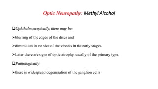 Optic Neuropathy: Methyl Alcohol
Ophthalmoscopically, there may be:
blurring of the edges of the discs and
diminution in the size of the vessels in the early stages.
Later there are signs of optic atrophy, usually of the primary type.
Pathologically:
there is widespread degeneration of the ganglion cells
 
