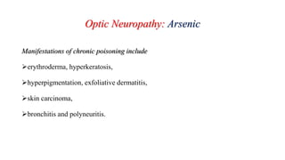 Optic Neuropathy: Arsenic
Manifestations of chronic poisoning include
erythroderma, hyperkeratosis,
hyperpigmentation, exfoliative dermatitis,
skin carcinoma,
bronchitis and polyneuritis.
 
