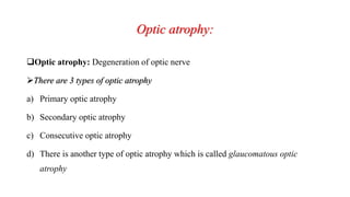 Optic atrophy:
Optic atrophy: Degeneration of optic nerve
There are 3 types of optic atrophy
a) Primary optic atrophy
b) Secondary optic atrophy
c) Consecutive optic atrophy
d) There is another type of optic atrophy which is called glaucomatous optic
atrophy
 