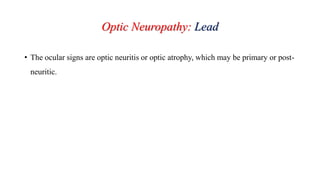 Optic Neuropathy: Lead
• The ocular signs are optic neuritis or optic atrophy, which may be primary or post-
neuritic.
 