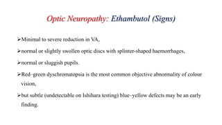 Optic Neuropathy: Ethambutol (Signs)
Minimal to severe reduction in VA,
normal or slightly swollen optic discs with splinter-shaped haemorrhages,
normal or sluggish pupils.
Red–green dyschromatopsia is the most common objective abnormality of colour
vision,
but subtle (undetectable on Ishihara testing) blue–yellow defects may be an early
finding.
 