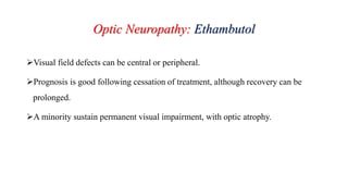 Optic Neuropathy: Ethambutol
Visual field defects can be central or peripheral.
Prognosis is good following cessation of treatment, although recovery can be
prolonged.
A minority sustain permanent visual impairment, with optic atrophy.
 