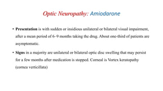 Optic Neuropathy: Amiodarone
• Presentation is with sudden or insidious unilateral or bilateral visual impairment,
after a mean period of 6–9 months taking the drug. About one-third of patients are
asymptomatic.
• Signs in a majority are unilateral or bilateral optic disc swelling that may persist
for a few months after medication is stopped. Corneal is Vortex keratopathy
(cornea verticillata)
 